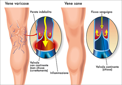 Ritorno Venoso